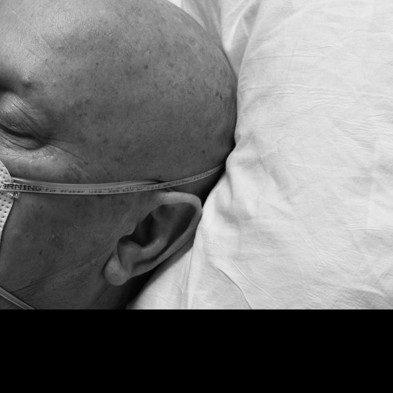 It’s not clear whether bald people get more ill with Covid-19