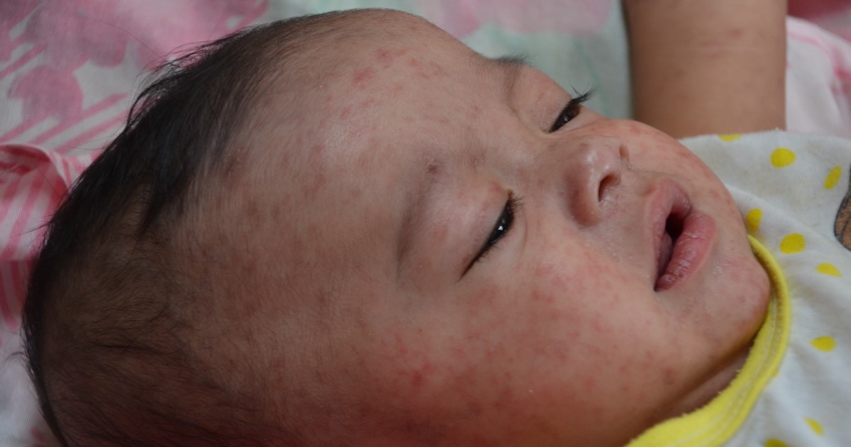 A German court did not rule that the measles virus doesn’t exist
