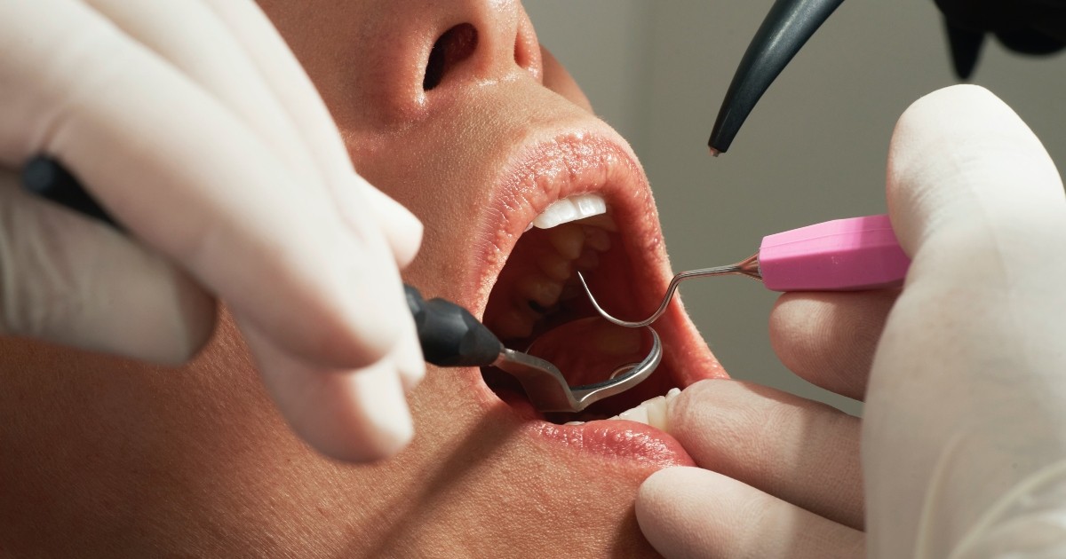 The rise of DIY dentistry: Britons doing their own fillings to avoid NHS  bill, Poverty