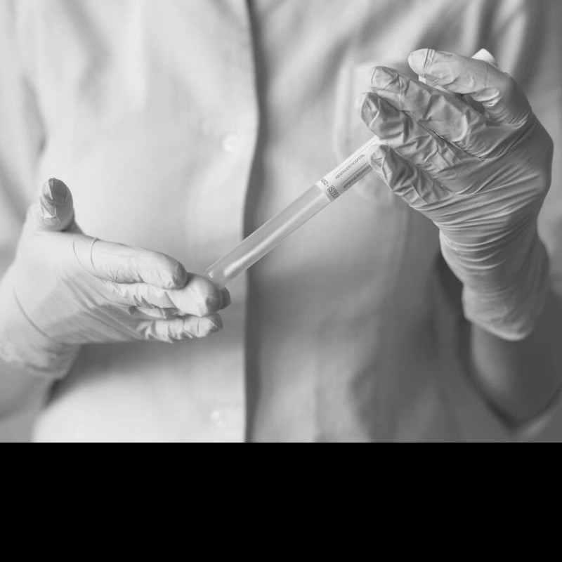 HPV testing kits are not smear tests