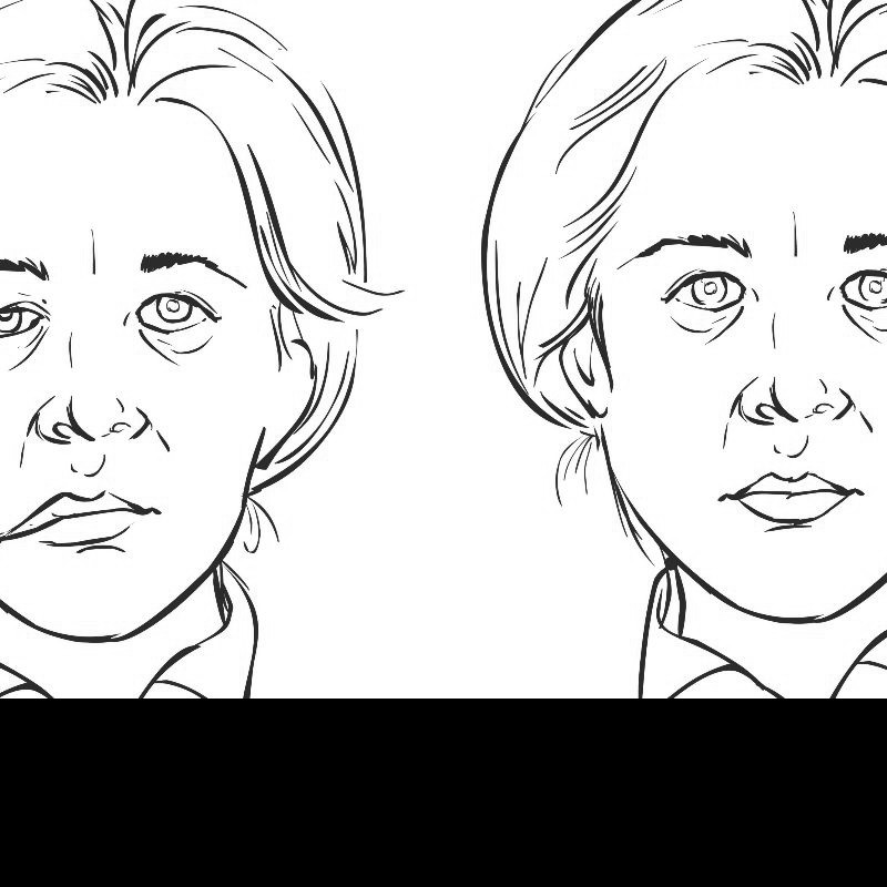 Some on the Pfizer vaccine trials did get Bell’s palsy, but not more than we’d expect by chance