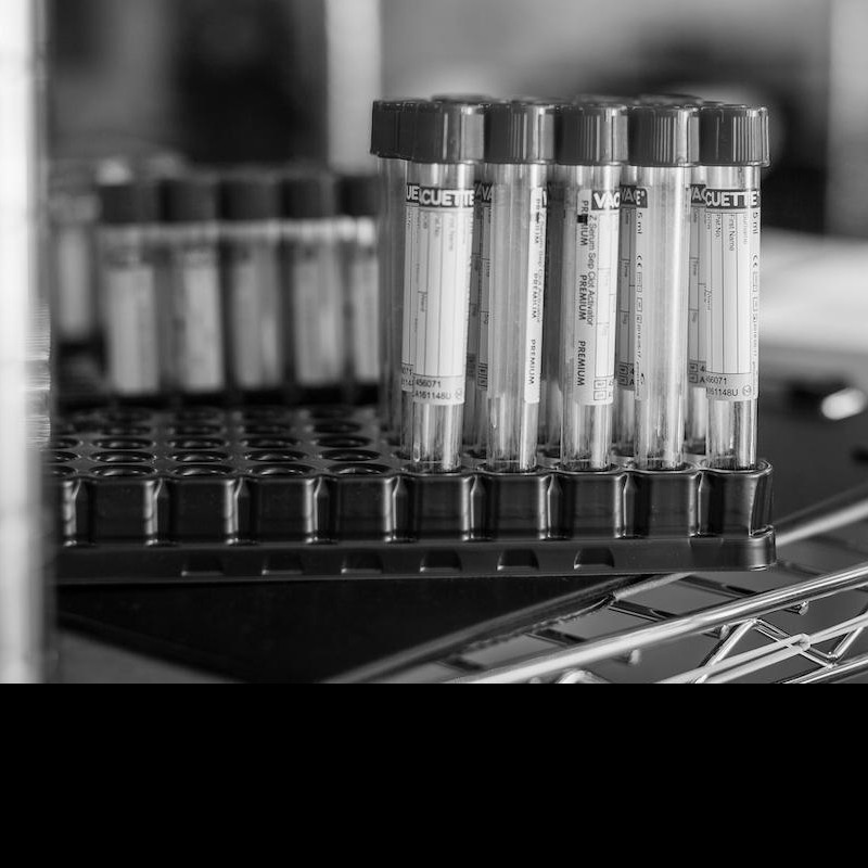 This data does not show tests for coronavirus being ordered pre-2020