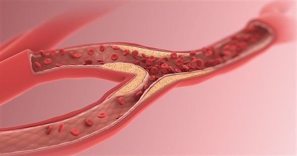 1200px-arteriole_resize.jpg