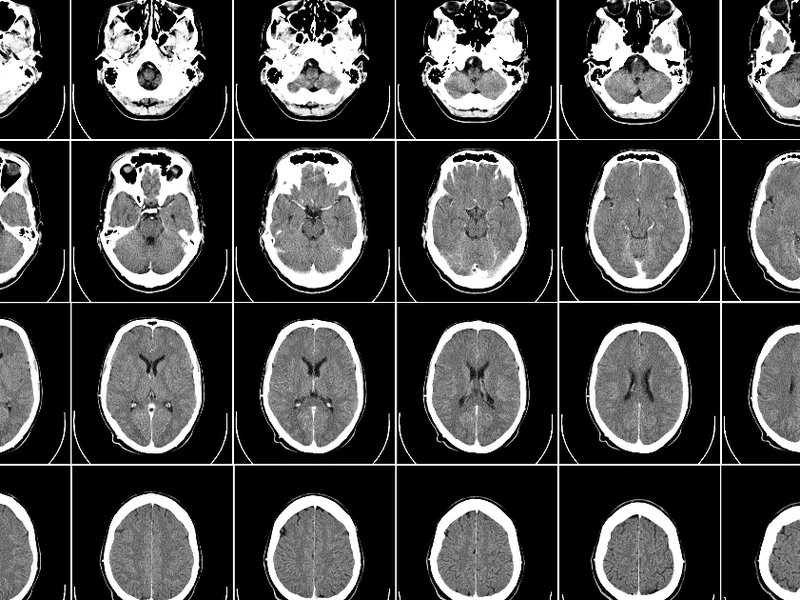 brains-cropped.jpg