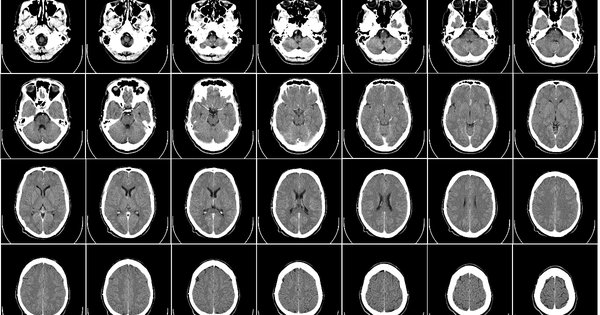 brains-cropped.jpg