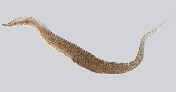 enterobius_vermicularis_(ypm_iz_093279).jpg