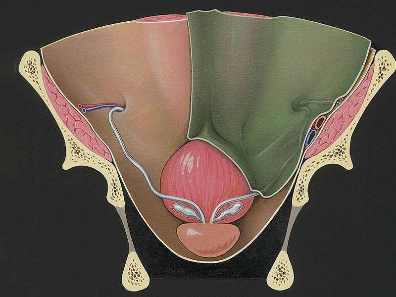 Prostate and adjacent tissue