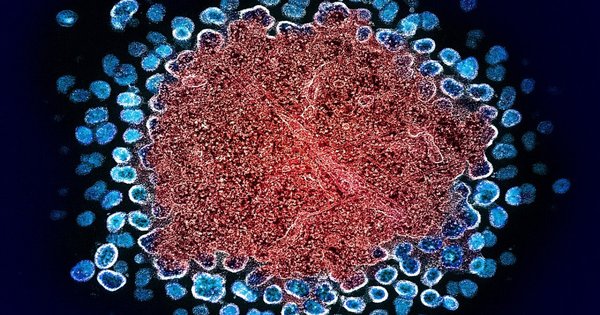 hiv-1_virus_particles_replicating_(52532878449).jpg