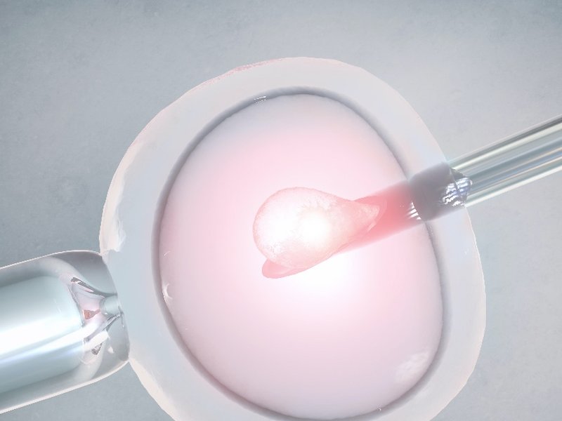 ivf.jpg
