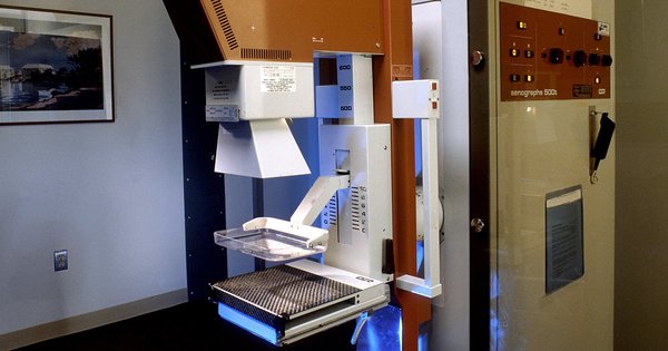 mammography_machine_resize.jpg
