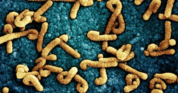 marburg_virus_particles_(52774910982)_resize.jpg