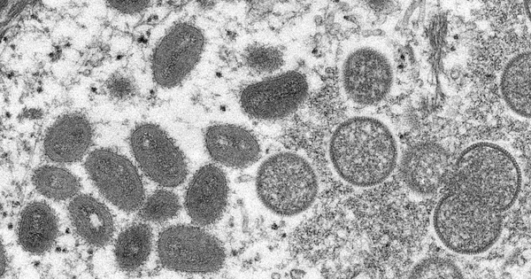 monkeypox_virion_-_cdc.png