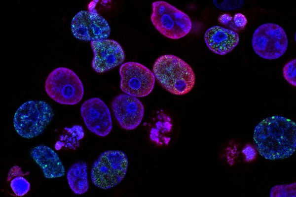 national-cancer-institute-l7en7lb-ovc-unsplash_1.jpg
