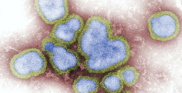 spanishflu.jpg